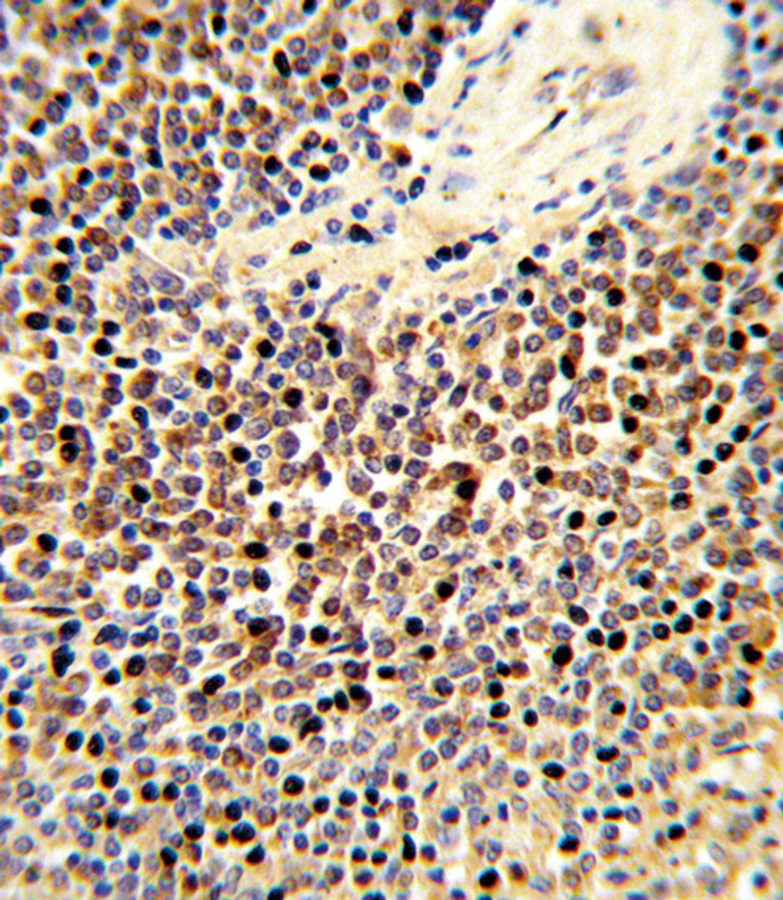 Formalin-fixed and paraffin-embedded human spleen tissue reacted with CYP24A1 Antibody, which was peroxidase-conjugated to the secondary antibody, followed by DAB staining.