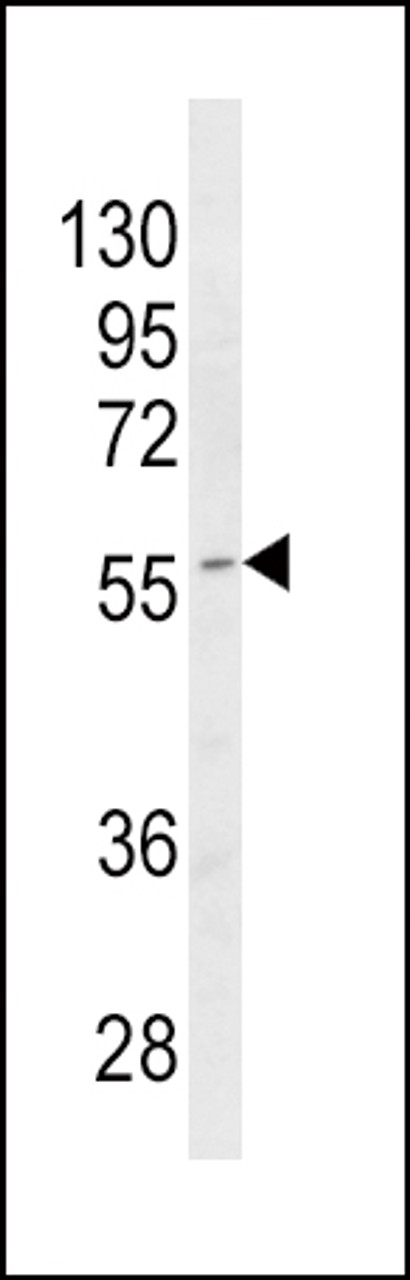 Western blot analysis of CYP4B1 Antibody in MDA-MB468 cell line lysates (35ug/lane)