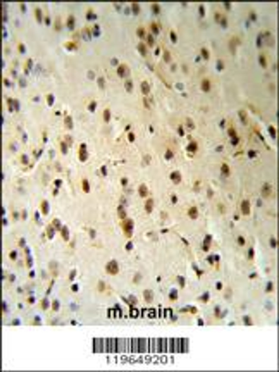TARSL2 Antibody (RB19649) IHC analysis in formalin fixed and paraffin embedded human brain tissue followed by peroxidase conjugation of the secondary antibody and DAB staining.