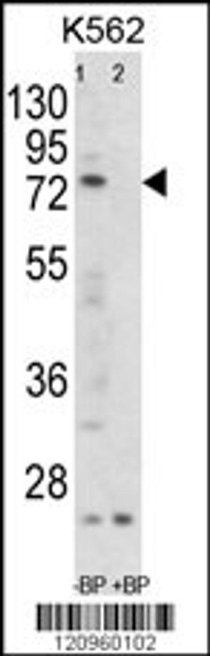 Western blot analysis of FLCN Antibody Pab pre-incubated without (lane 1) and with (lane 2) blocking peptide in K562 cell line lysate