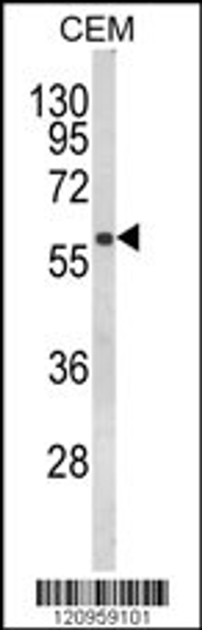 Western blot analysis of FLCN Antibody in CEM cell line lysates (35ug/lane)