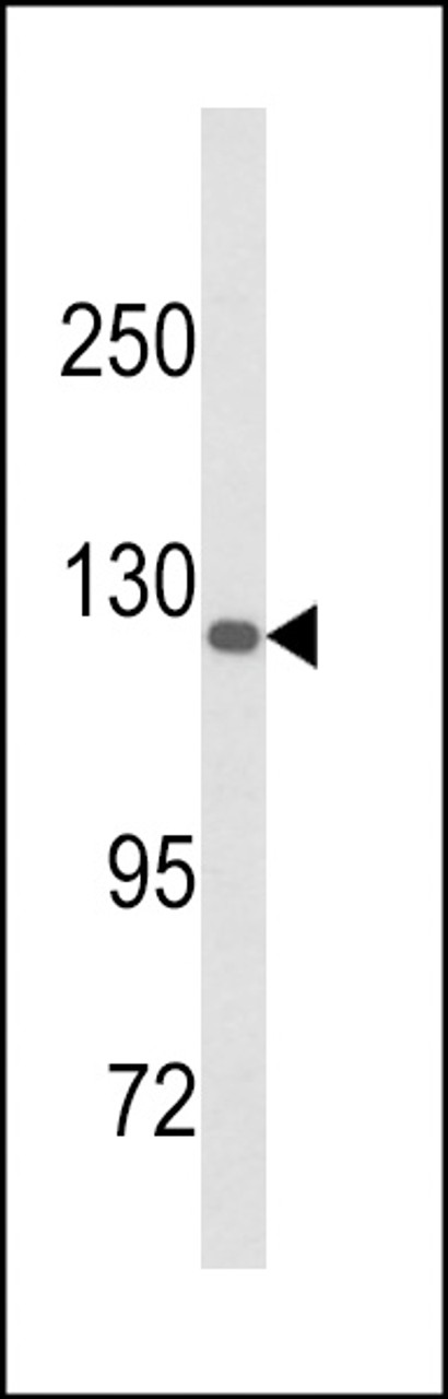 Western blot analysis of DSC1 Antibody in A375 cell line lysates (35ug/lane)