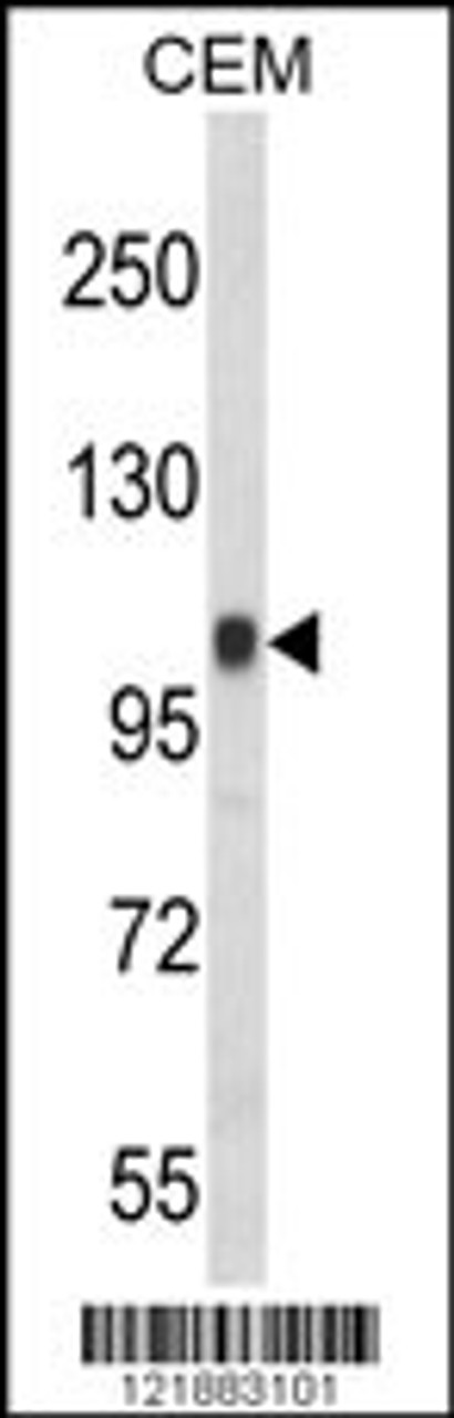Western blot analysis of ITGB3 Antibody in CEM cell line lysates (35ug/lane) (2ug/ml)