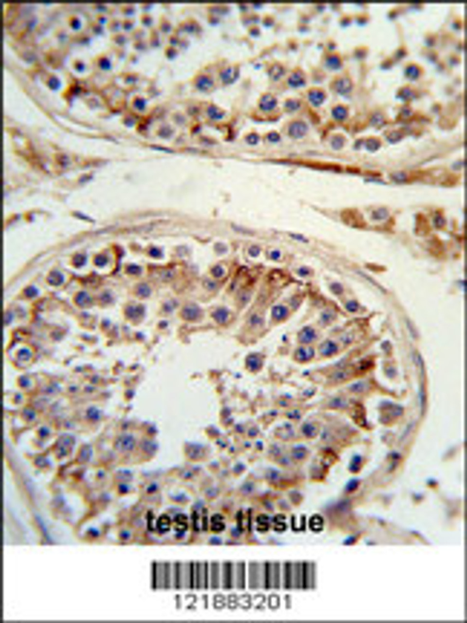 Formalin-fixed and paraffin-embedded human testis tissue reacted with ITGB3 Antibody, which was peroxidase-conjugated to the secondary antibody, followed by DAB staining.