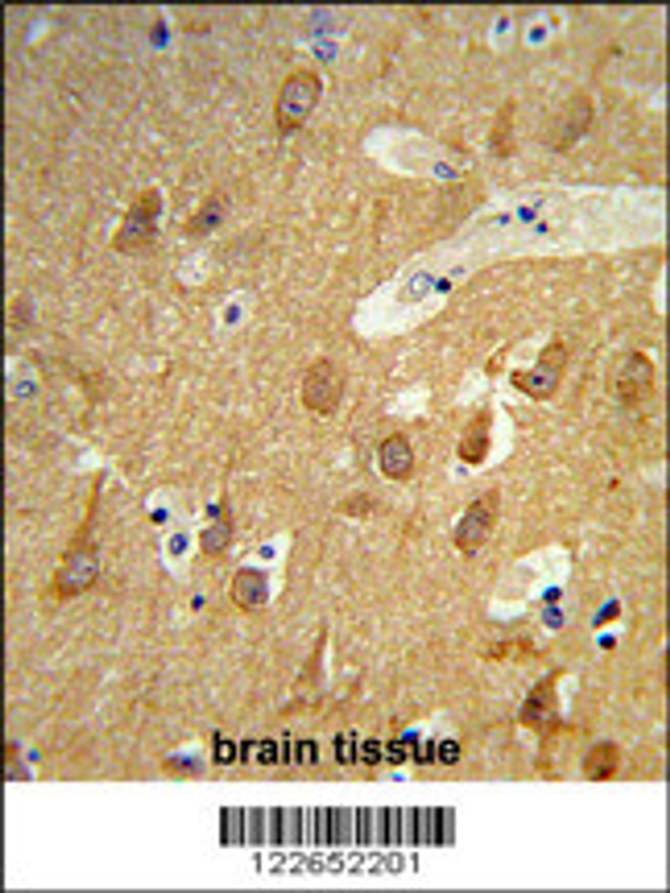 Formalin-fixed and paraffin-embedded human brain tissue reacted with TSPAN12 Antibody, which was peroxidase-conjugated to the secondary antibody, followed by DAB staining.