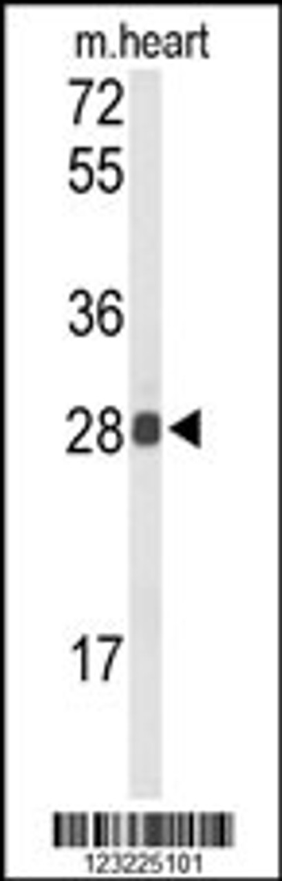 Western blot analysis of TSPAN1 Antibody in mouse heart tissue lysates (35ug/lane)