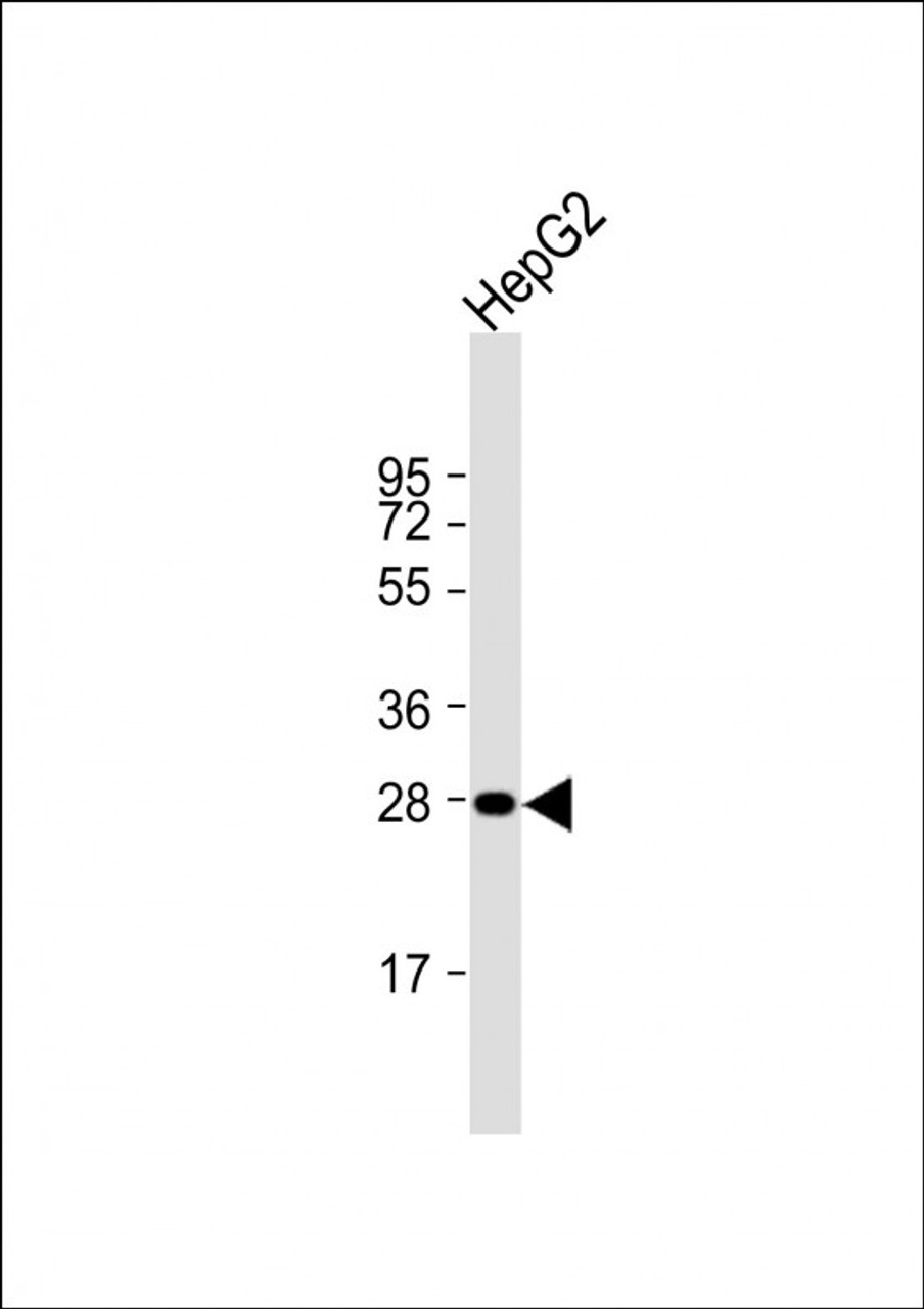 Western Blot at 1:1000 dilution + HepG2 whole cell lysate Lysates/proteins at 20 ug per lane.