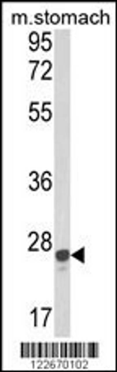 Western blot analysis of GSTA1 Antibody in mouse stomach tissue lysates (35ug/lane)