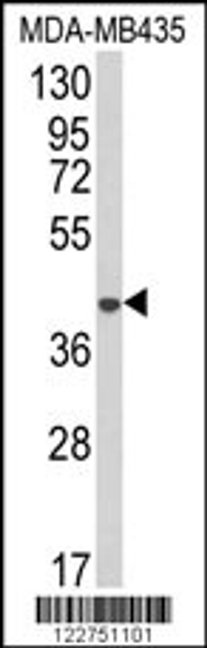 Western blot analysis of AGPAT4 Antibody in MDA-MB435 cell line lysates (35ug/lane)