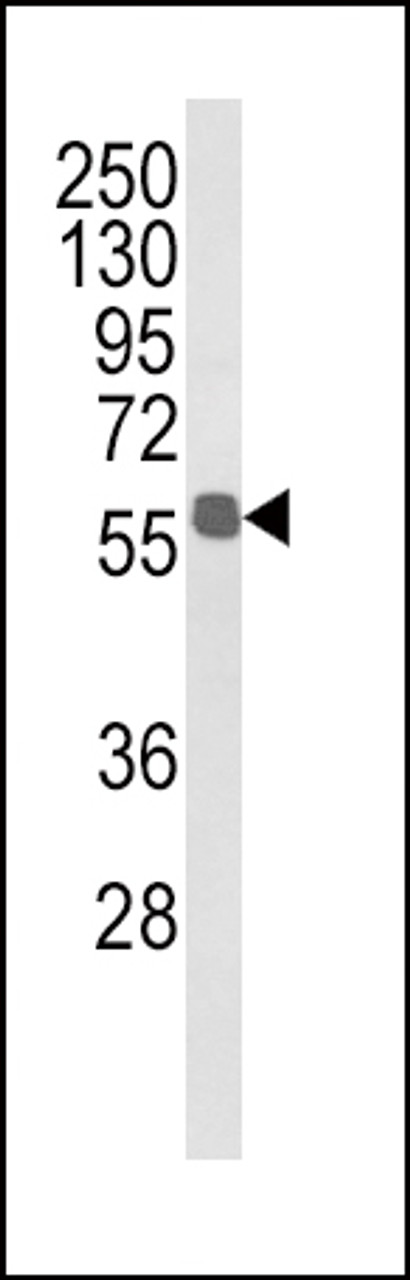 Western blot analysis of ALDH3B1 Antibody in MDA-MB231 cell line lysates (35ug/lane)