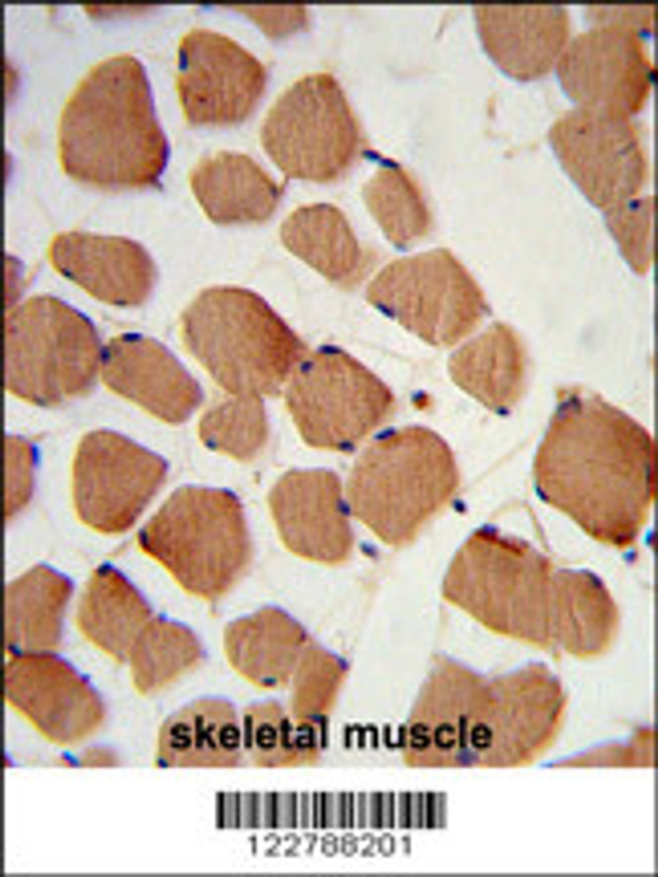 Formalin-fixed and paraffin-embedded human skeletal muscle reacted with PHYH2 Antibody, which was peroxidase-conjugated to the secondary antibody, followed by DAB staining.