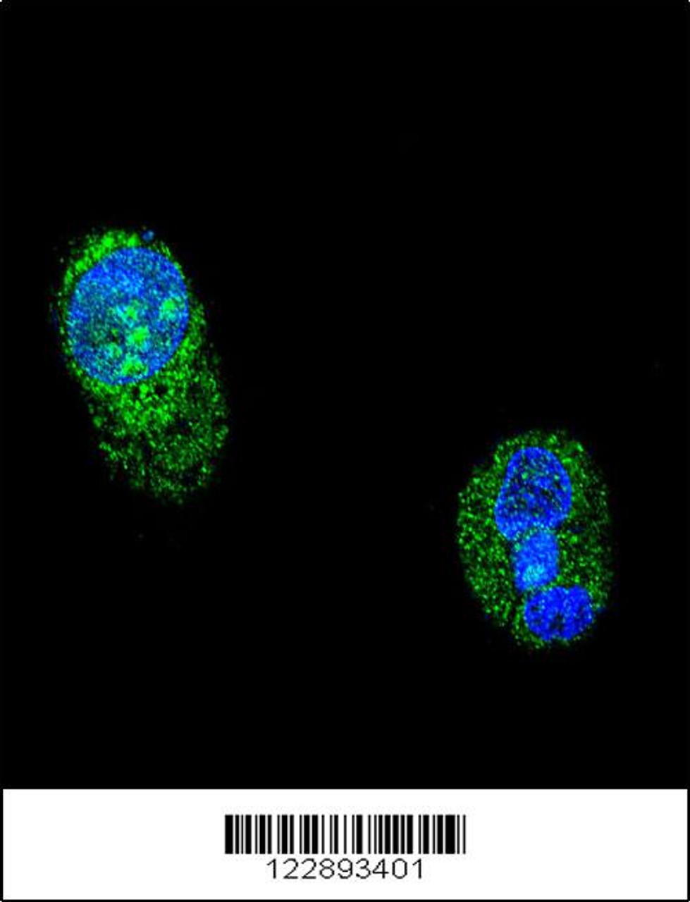 Confocal immunofluorescent analysis of HNF1A Antibody with HepG2 cell followed by Alexa Fluor 488-conjugated goat anti-rabbit lgG (green) . DAPI was used to stain the cell nuclear (blue) .