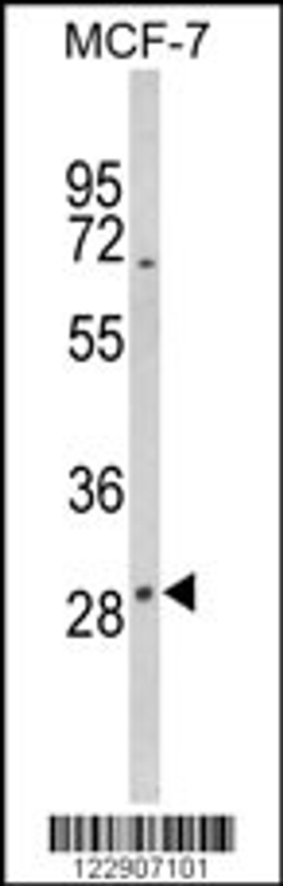 Western blot analysis of DIO2 Antibody in MCF-7 cell line lysates (35ug/lane)