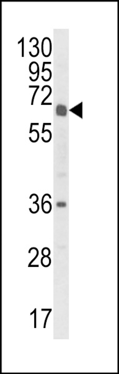 Western blot analysis of CYP2C18 Antibody in HL-60 cell line lysates (35ug/lane)
