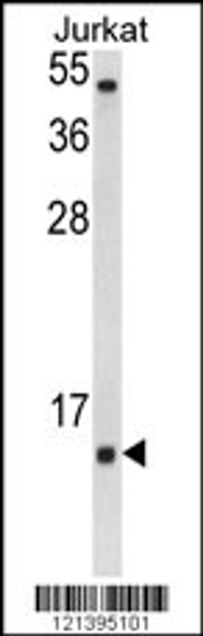 Western blot analysis of SOD1 Antibody in Jurkat cell line lysates (35ug/lane)