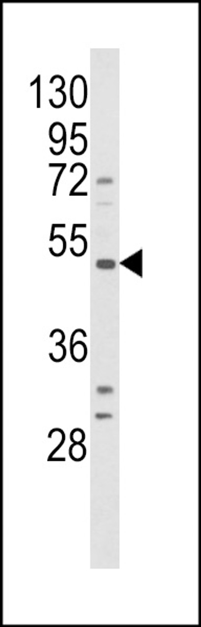 Western blot analysis of BDKRB1 Antibody in HepG2 cell line lysates (35ug/lane)