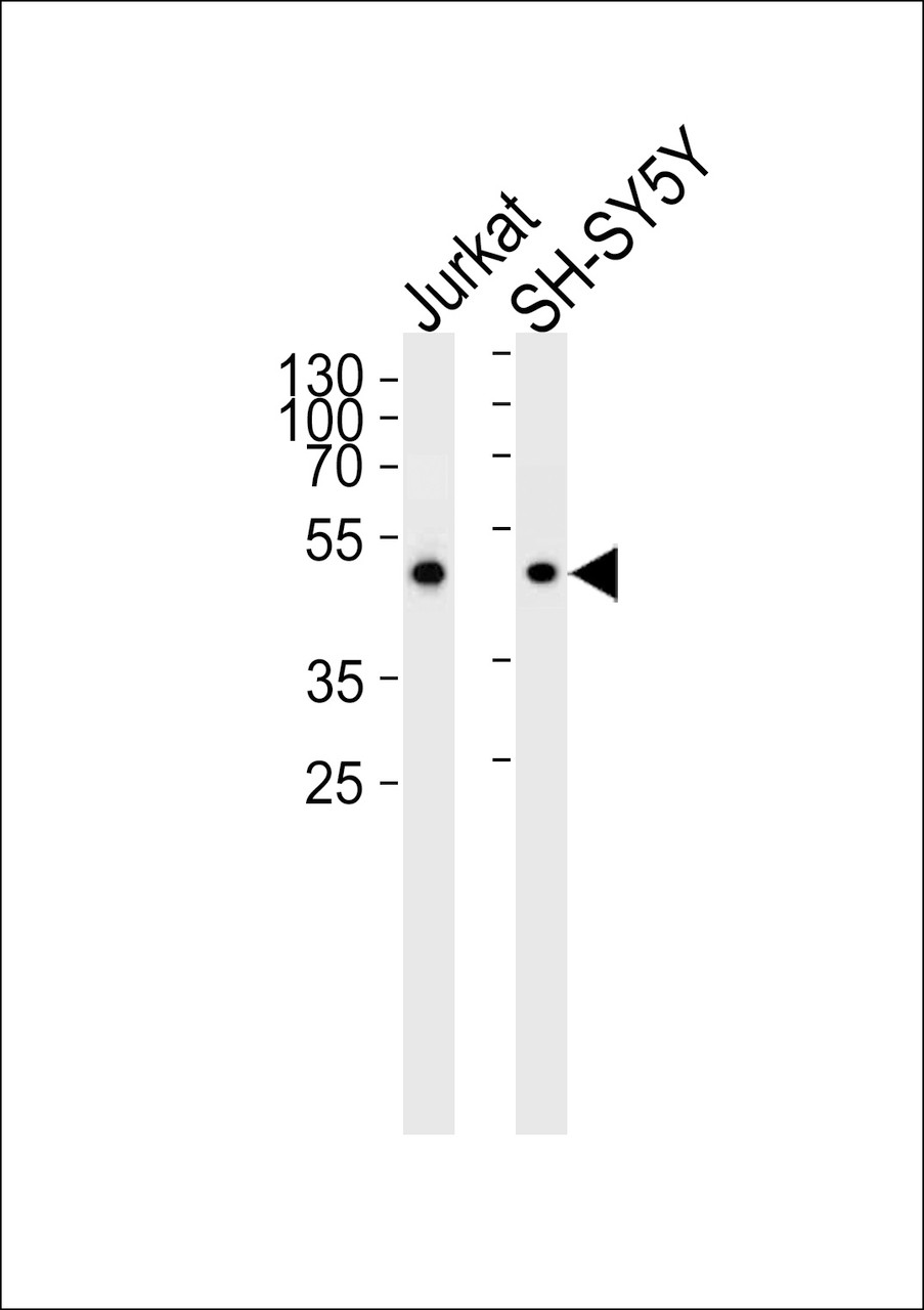 Western blot analysis in Jurkat and SH-SY5Y cell lysates (35ug/lane) . This demonstrates that the detected ANXA7 protein (arrow) .