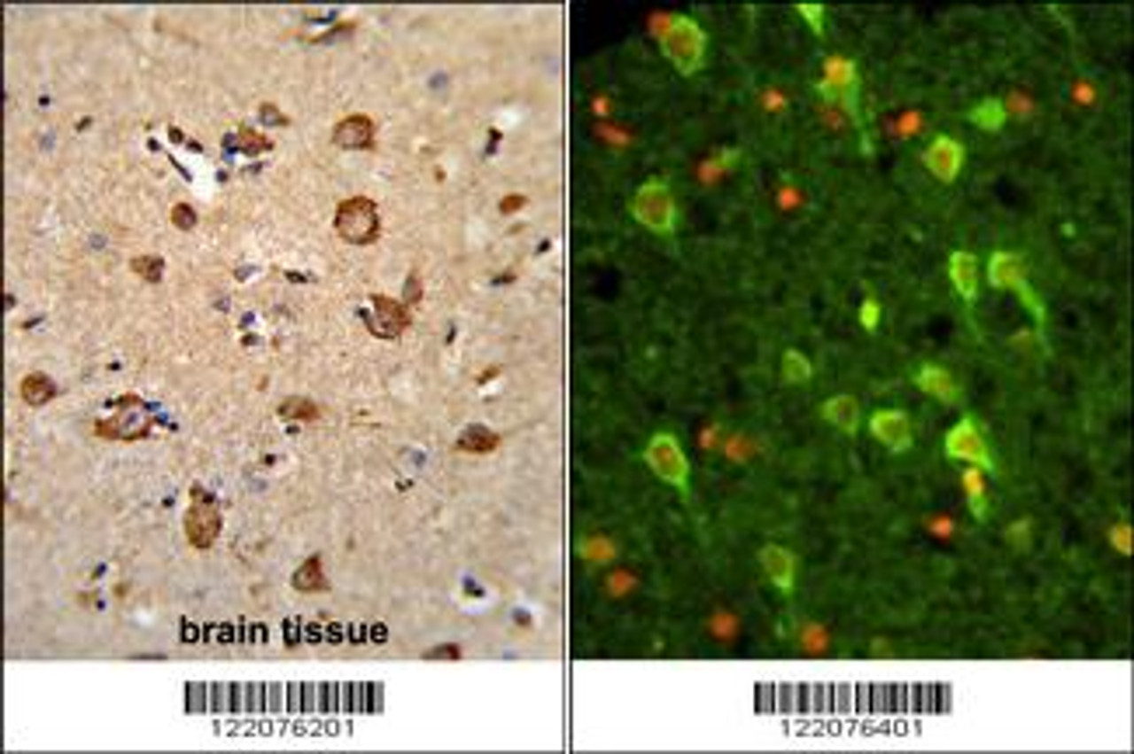 (LEFT) Formalin-fixed and paraffin-embedded human brain tissue reacted with ANXA7 Antibody, which was peroxidase-conjugated to the secondary antibody, followed by DAB staining. (RIGHT) Immunofluorescence analysis of ANXA7 Antibody with paraffin-embedded human brain tissue . 0.05 mg/ml primary antibody was followed by FITC-conjugated goat anti-rabbit lgG (whole molecule) . FITC emits green fluorescence. Red counterstaining is PI.