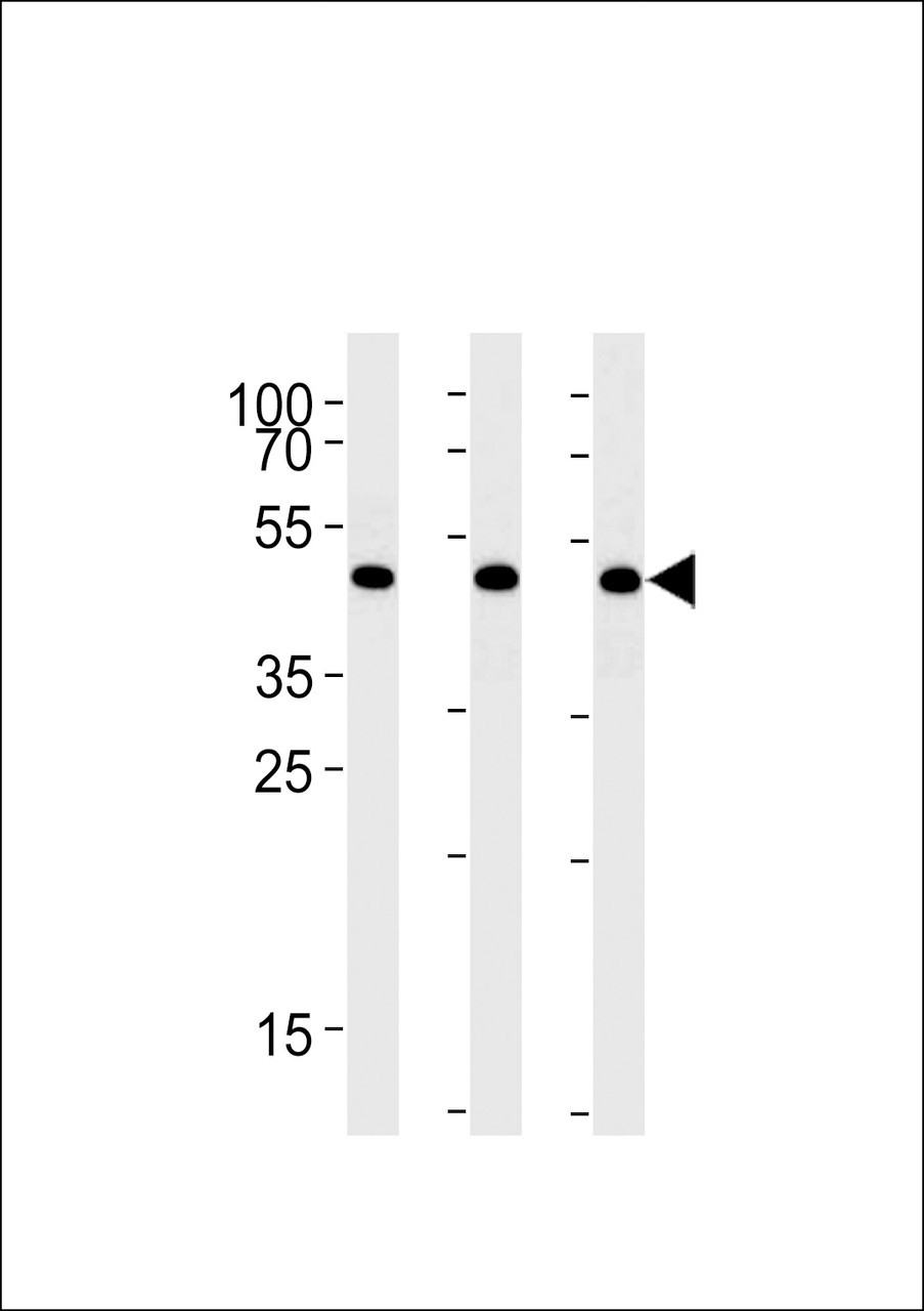 Western blot analysis in A431, Hela, Jurkat cell line lysates (35ug/lane) .