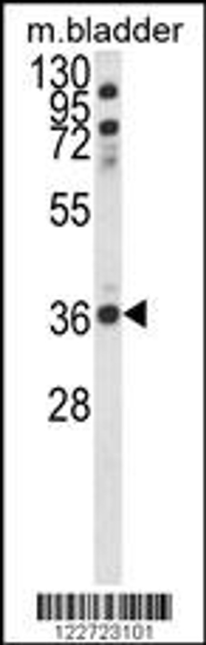Western blot analysis of CCDC3 Antibody in mouse bladder tissue lysates (35ug/lane)