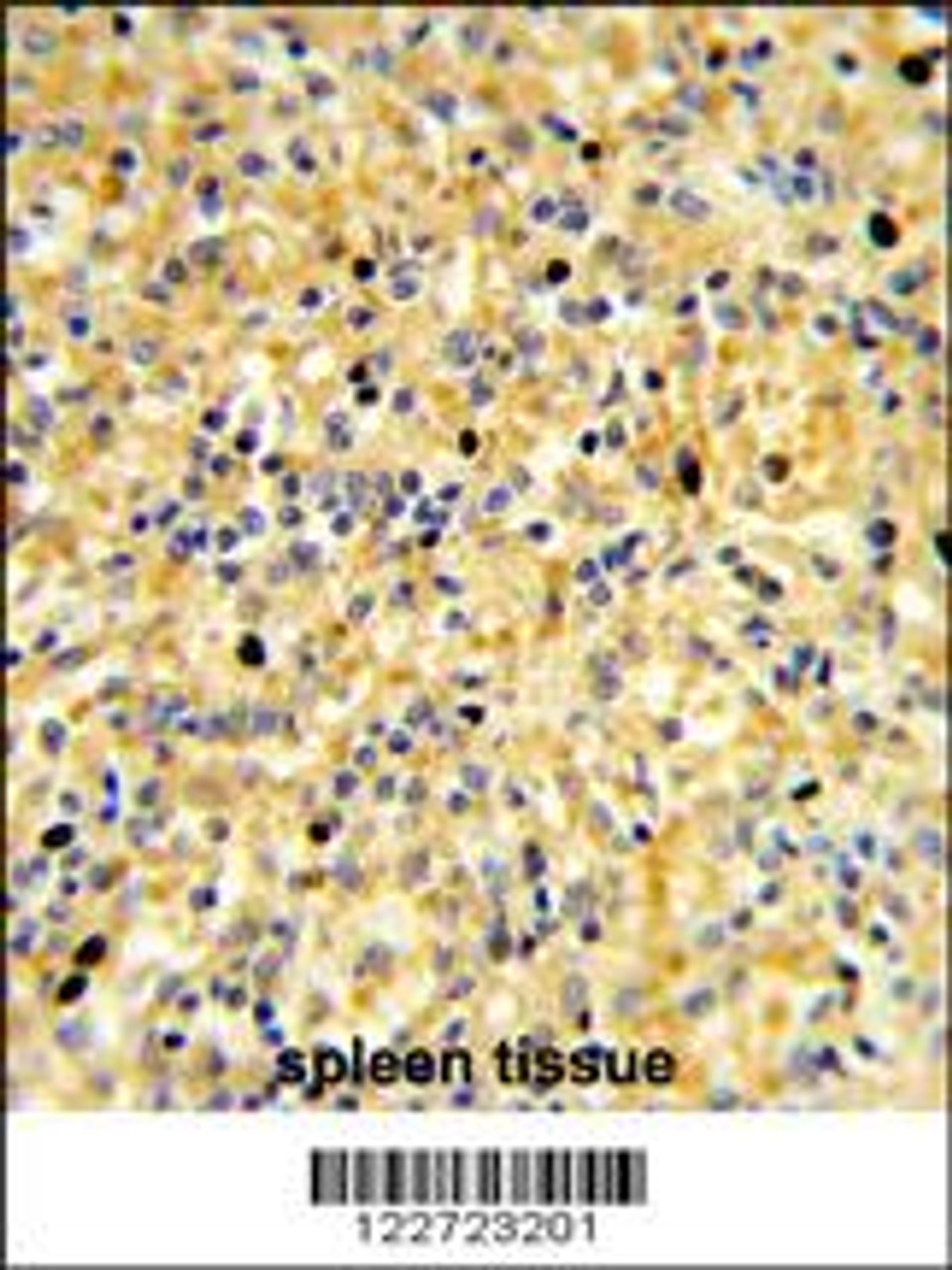 Formalin-fixed and paraffin-embedded human spleen reacted with CCDC3 Antibody, which was peroxidase-conjugated to the secondary antibody, followed by DAB staining.