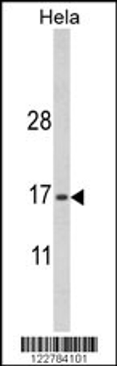 Western blot analysis of MPV17 Antibody in Hela cell line lysates (35ug/lane)