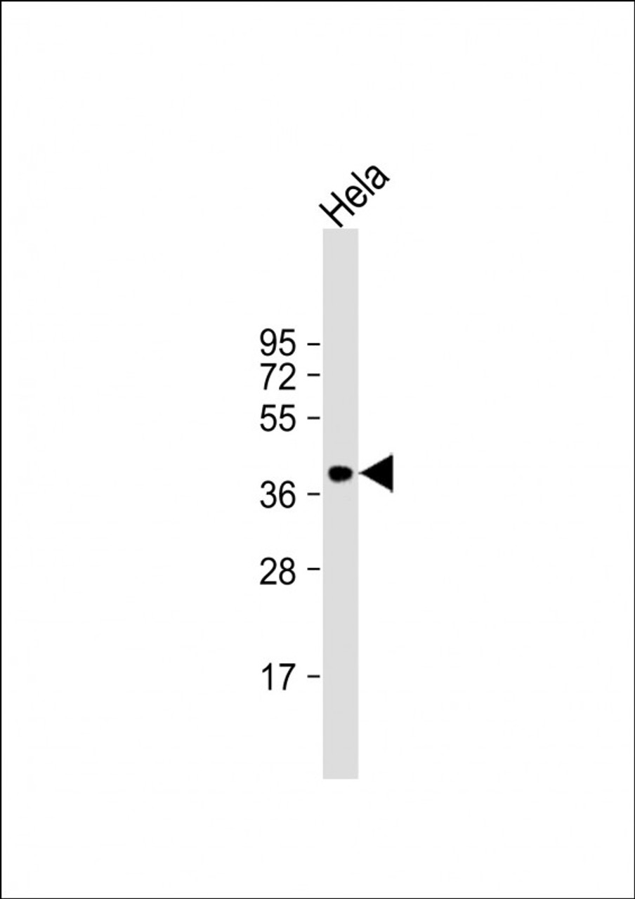 Western Blot at 1:1000 dilution + Hela whole cell lysate Lysates/proteins at 20 ug per lane.