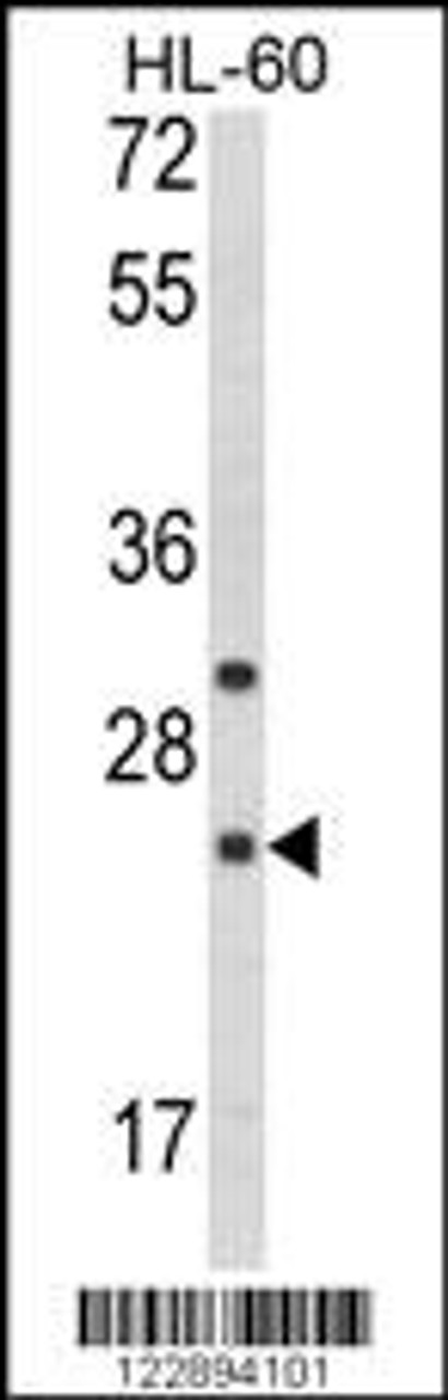 Western blot analysis of RGS1 Antibody in HL-60 cell line lysates (35ug/lane)