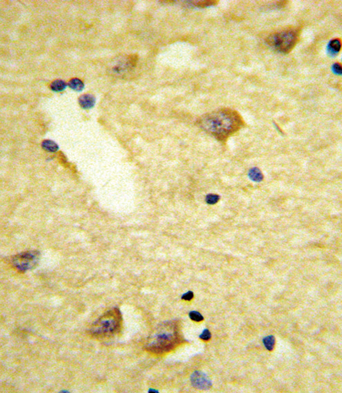 Formalin-fixed and paraffin-embedded human brain tissue reacted with DRD4 Antibody, which was peroxidase-conjugated to the secondary antibody, followed by DAB staining.