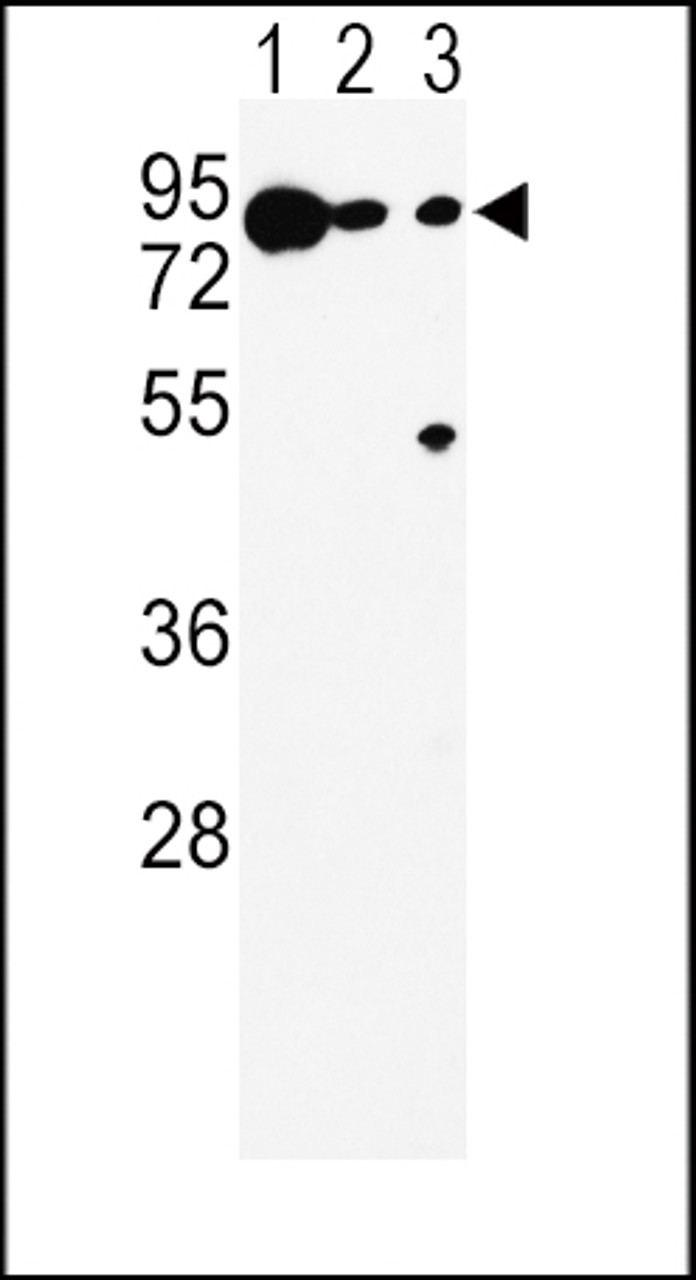 Western blot analysis of DCT Antibody in K562 (lane 1) , A375 (lane 2) , Ramos (lane 3) cell line lysates (35ug/lane)