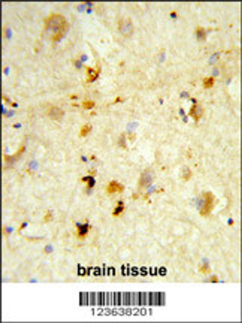 Formalin-fixed and paraffin-embedded human brain tissue reacted with ITGBL1 Antibody, which was peroxidase-conjugated to the secondary antibody, followed by DAB staining.