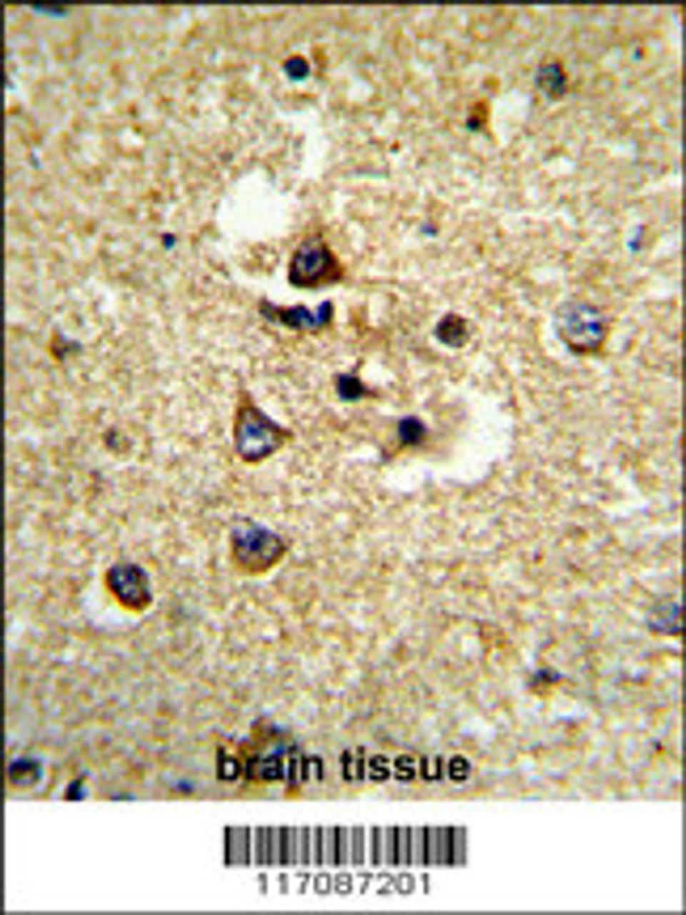 Formalin-fixed and paraffin-embedded human brain tissue reacted with CYP7B1 Antibody, which was peroxidase-conjugated to the secondary antibody, followed by DAB staining.