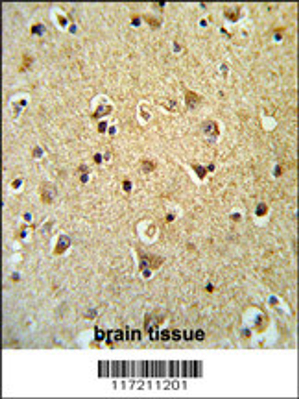 Formalin-fixed and paraffin-embedded human brain tissue reacted with PPID Antibody (N-term) , which was peroxidase-conjugated to the secondary antibody, followed by DAB staining.