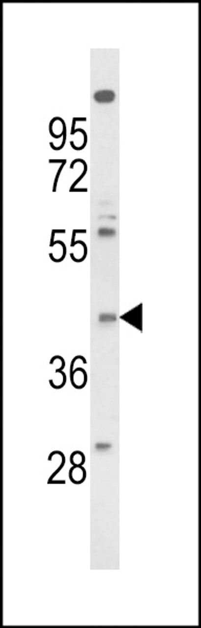 Western blot analysis of FPRL2 Antibody in NCI-H460 cell line lysates (35ug/lane)