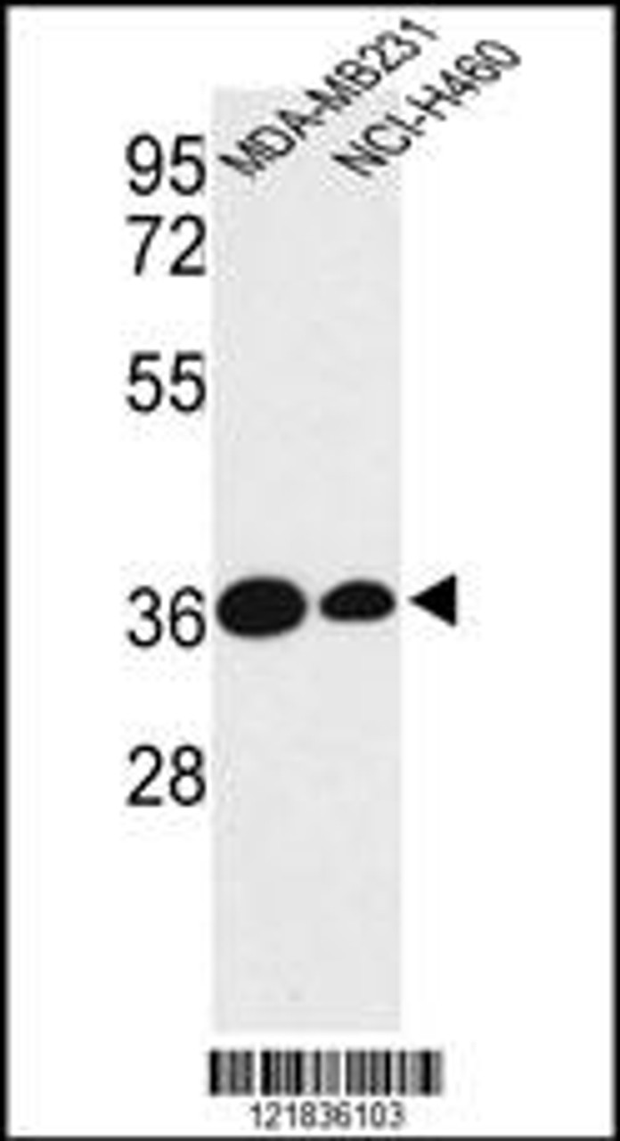 Western blot analysis of TAZ Antibody in MDA-MB231, NCI-H460 cell line lysates (35ug/lane)