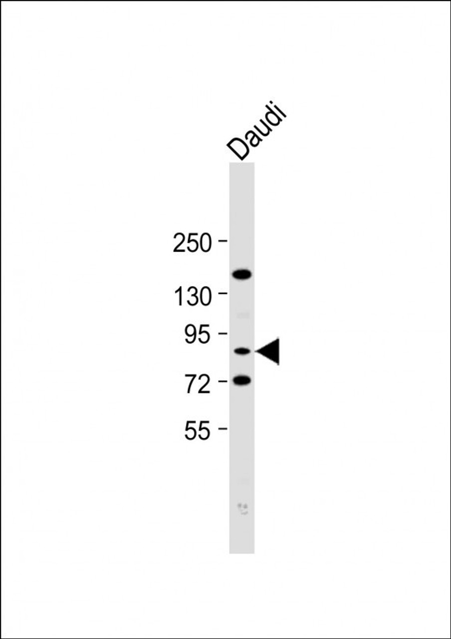 Western Blot at 1:2000 dilution + Daudi whole cell lysate Lysates/proteins at 20 ug per lane.