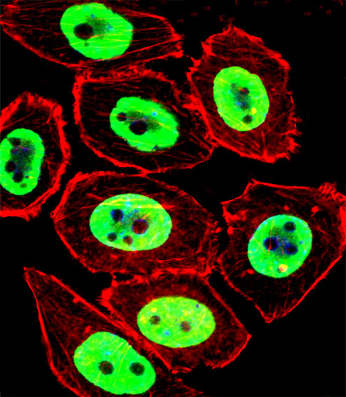 Fluorescent confocal image of U251 cell stained with EWSR1 Antibody .U251 cells were fixed with 4% PFA (20 min) , permeabilized with Triton X-100 (0.1%, 10 min) , then incubated with EWSR1 primary antibody (1:25) . For secondary antibody, Alexa Fluor 488 conjugated donkey anti-rabbit antibody (green) was used (1:400) .Cytoplasmic actin was counterstained with Alexa Fluor 555 (red) conjugated Phalloidin (7units/ml) . Nuclei were counterstained with DAPI (blue) (10 ug/ml, 10 min) .EWSR1 immunoreactivity is localized to Nucleus significantly.