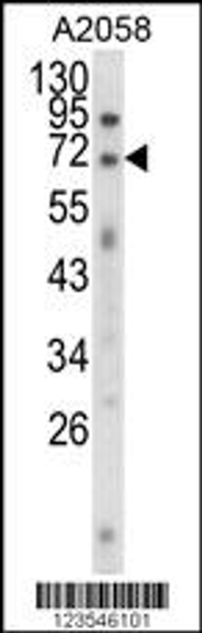 Western blot analysis of EWSR1 Antibody in A2058 cell line lysates (35ug/lane)