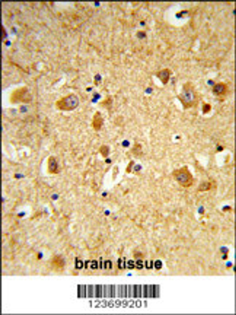 Formalin-fixed and paraffin-embedded human brain tissue reacted with DNM3 Antibody, which was peroxidase-conjugated to the secondary antibody, followed by DAB staining.