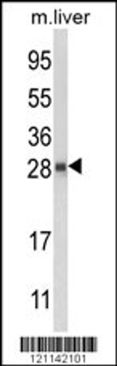 Western blot analysis of QDPR Antibody in mouse liver tissue lysates (35ug/lane)