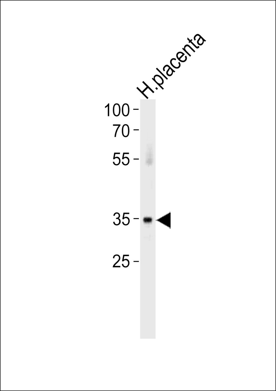 Western blot analysis in huamn placenta tissue lysates (35ug/lane) .