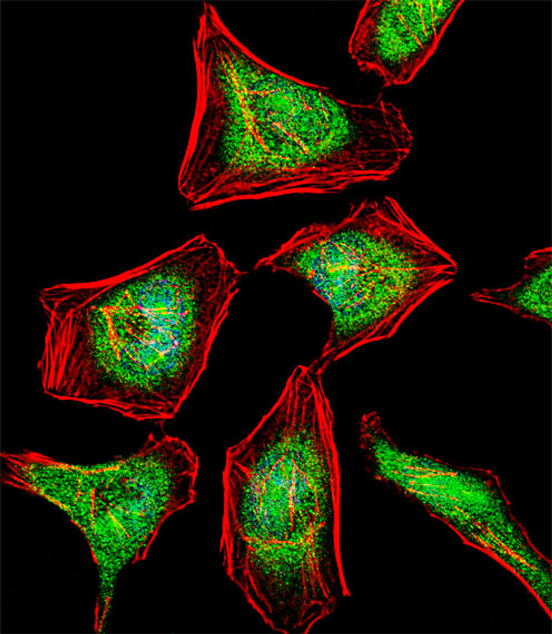 Fluorescent confocal image of Hela cell stained with ATF7 Antibody (N-term) .Hela cells were fixed with 4% PFA (20 min) , permeabilized with Triton X-100 (0.1%, 10 min) , then incubated with ATF7 primary antibody (1:25) . For secondary antibody, Alexa Fluor 488 conjugated donkey anti-rabbit antibody (green) was used (1:400) .Cytoplasmic actin was counterstained with Alexa Fluor 555 (red) conjugated Phalloidin (7units/ml) . Nuclei were counterstained with DAPI (blue) (10 ug/ml, 10 min) .ATF7 immunoreactivity is localized to Nucleus and Cytoplasm significantly.