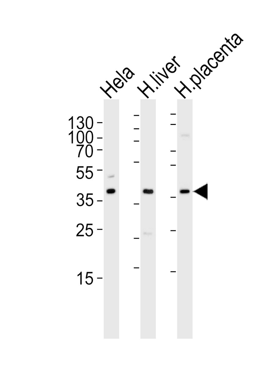 Western blot analysis of lysates from Hela cell line, human liver and placenta tissue lysate (from left to right) , using OLR1 Antibody at 1:1000 at each lane.