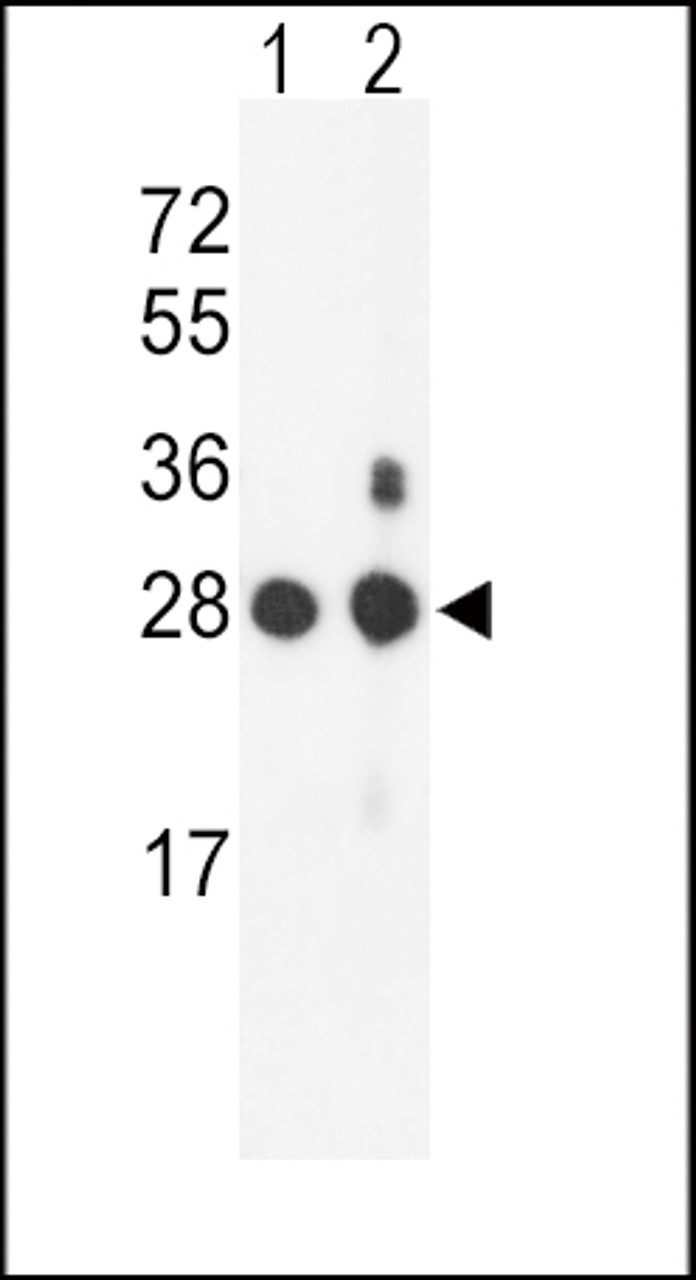 Western blot analysis of PSMB1 Antibody in mouse NIH-3T3 cell line (lane 1) and mouse bladder tissue (lane 2) lysates (35ug/lane)