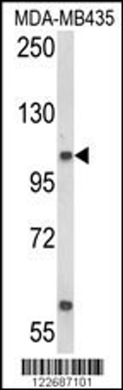 Western blot analysis of CASD1 Antibody in MDA-MB435 cell line lysates (35ug/lane)