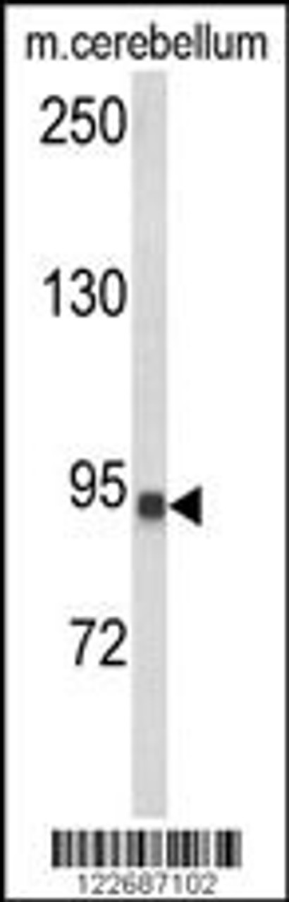 Western blot analysis of CASD1 Antibody in mouse cerebellum tissue lysates (35ug/lane)