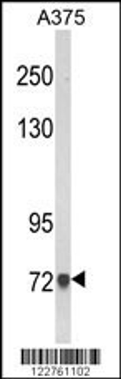 Western blot analysis of AMOTL2 Antibody in A375 cell line lysates (35ug/lane)