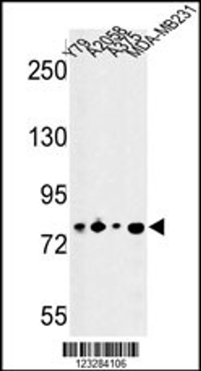 Western blot analysis of CSRP2BP Antibody in Y79, A2058, A375, MDA-MB231 cell line lysates (35ug/lane)