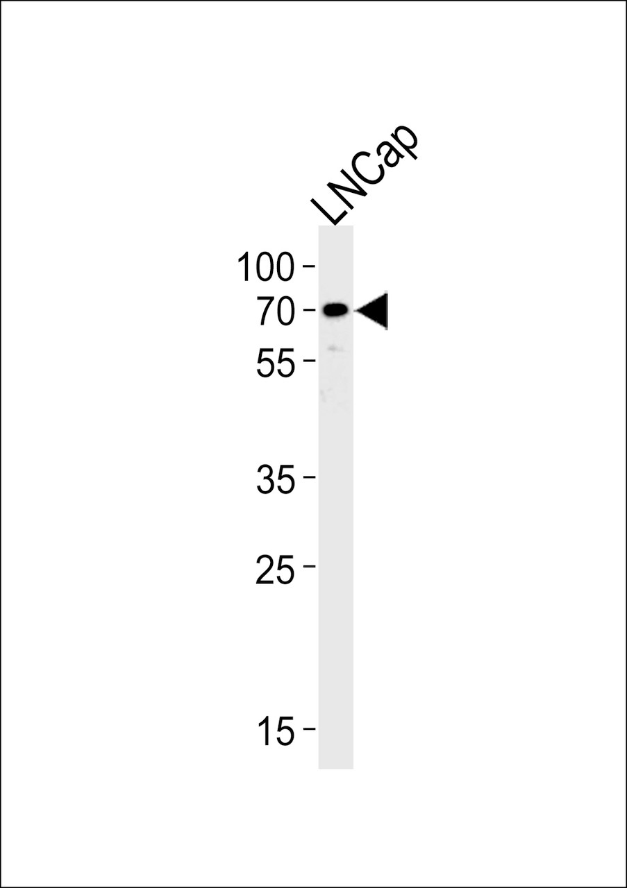 Western blot analysis of lysate from LNCap cell line, using CYP51A1 Antibody at 1:1000 at each lane.