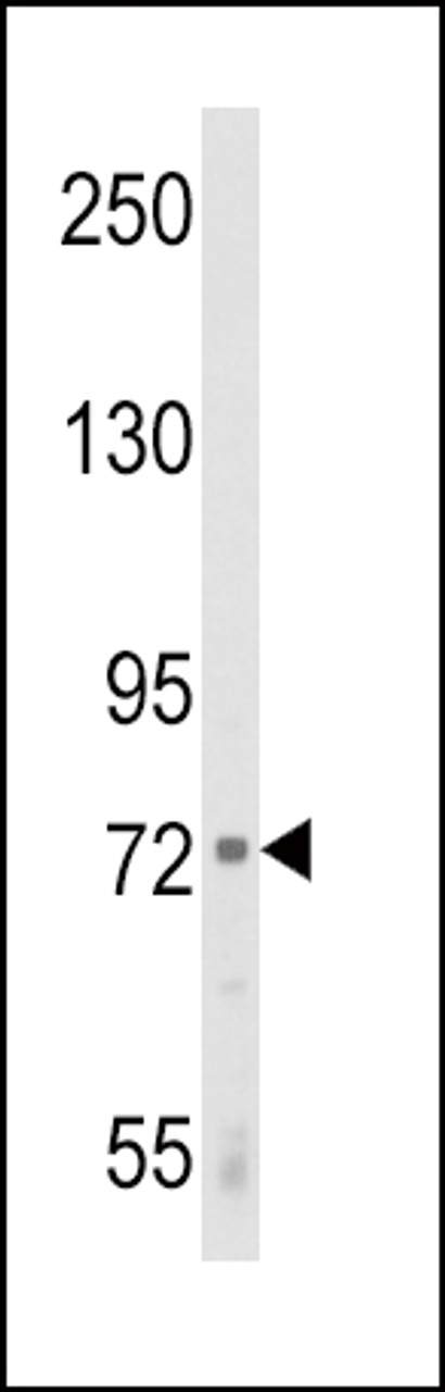 Western blot analysis of ALOX12 Antibody in K562 cell line lysates (35ug/lane)